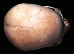 НОРМА коронального шва и сагиттального_top_view_skull001_big.jpg